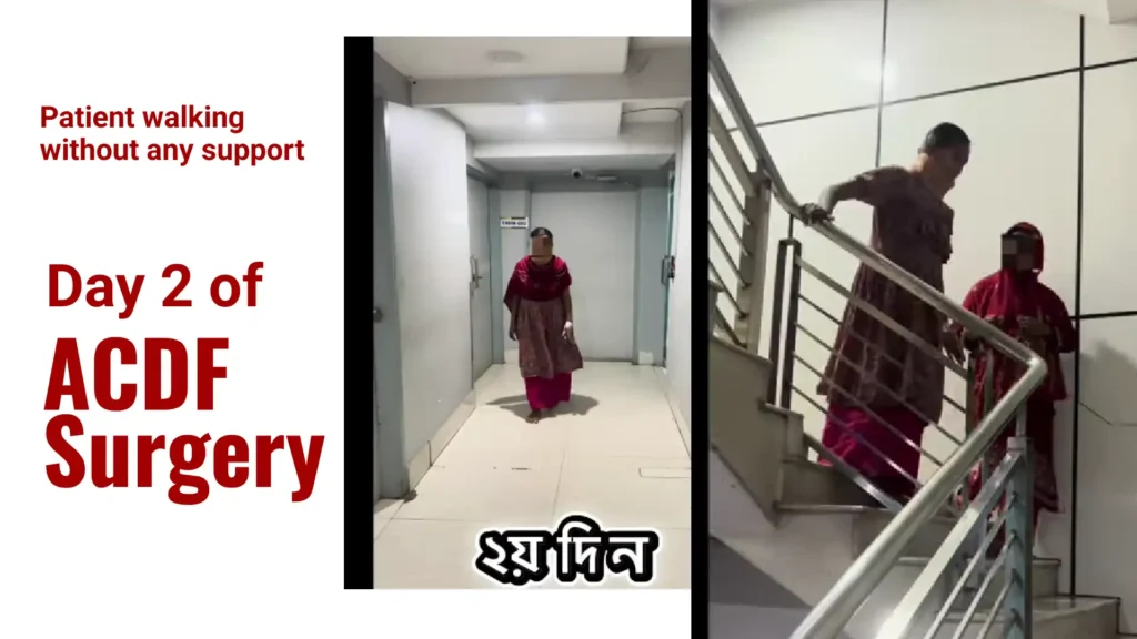 Day-2-of-ACDF-surgery_-Patient-walking-without-any-suppor