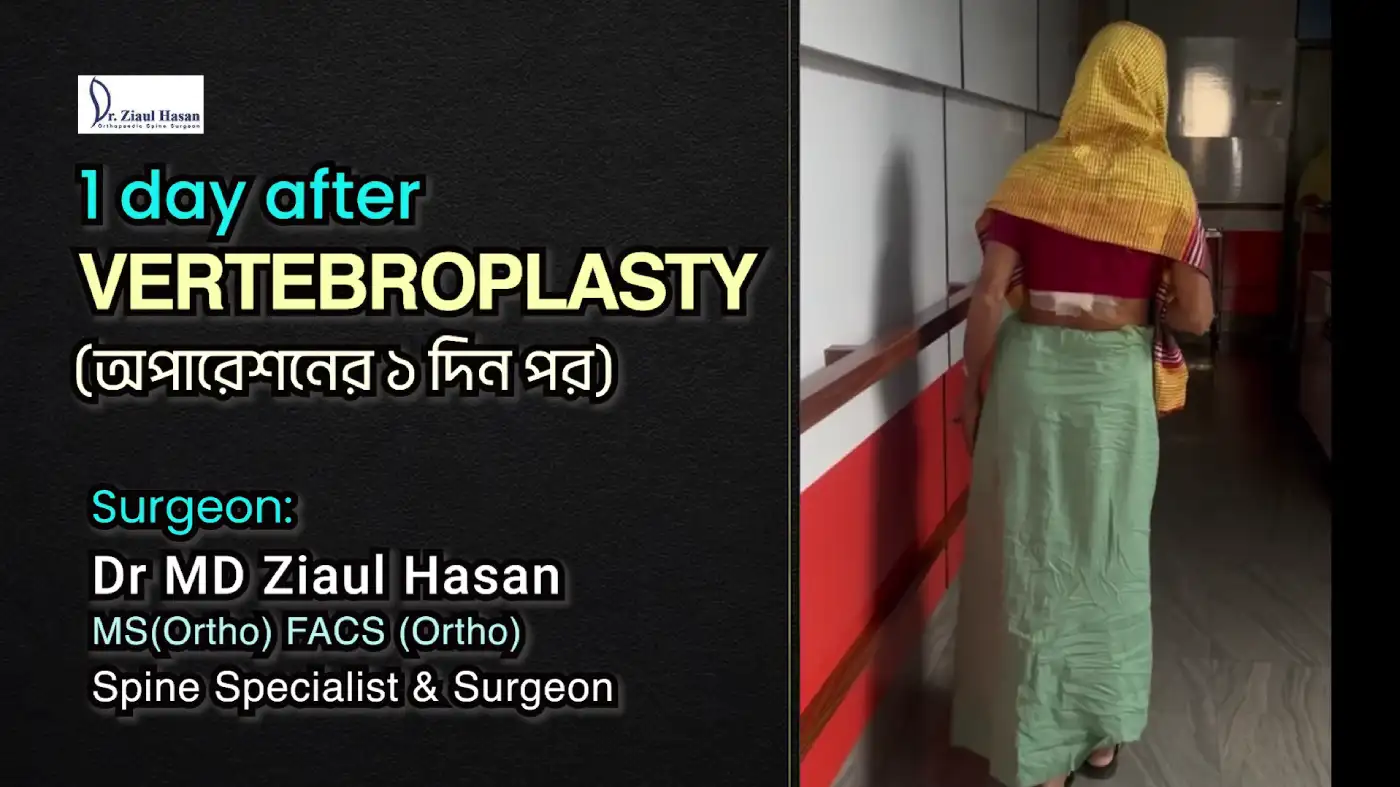 After 1 day of vertebroplasty surgery