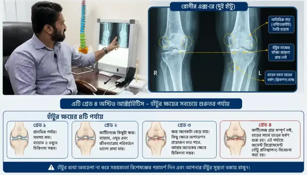 why his keen joint was always so painful- doctor described