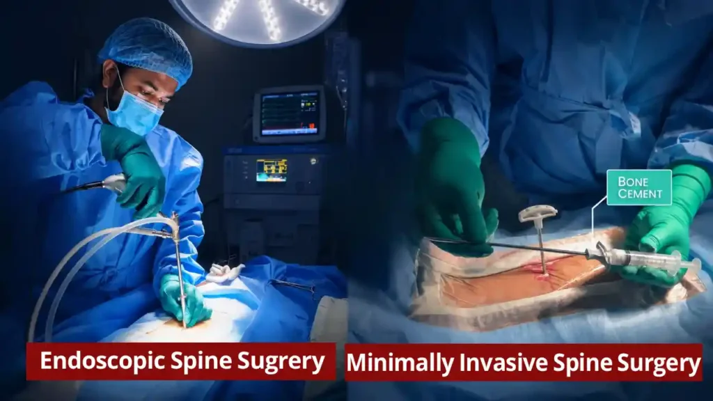 Minimally invasive spine surgery vs endoscopic spine surgery
